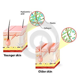 Skin aging
