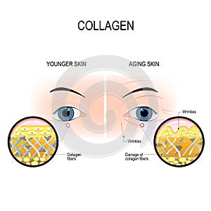 Skin aging and collagen damage photo