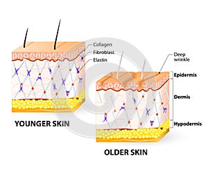 Skin aging