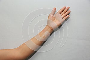 Skin allergies, Arms and wrists skin women photo