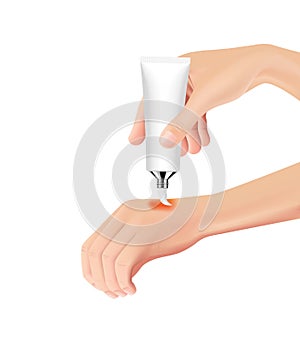 Skin burn injury treatment. First aid for burn wound vector illustration, hand with skin injury.