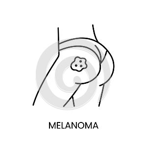 Skin cancer melanoma line icon vector cancer malignant disease on the buttock