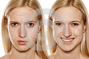 Skin care - cosmetic treatment