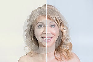 Skin care transformation