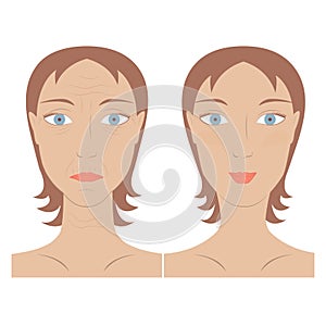 Skin care woman face before and after