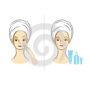 Skin care : woman with towel on head using cosmetics photo