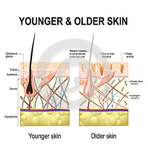 Skin changes or ageing skin.