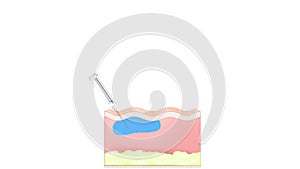 Skin changes after beauty injection