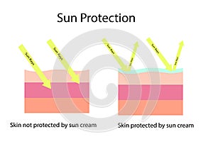 Skin compare between skin with broad-spectrum sunscreen protect both UVA and UVB and and normal sun screen which cannot