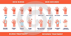 Skin first aid. Burns treatment, wounds and trauma symptoms. Degree burn, help hand healing with cream, bandaging and