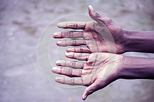 The skin of the hand goes to Kuchke. Skin wrinkles,skin shrinks. When working in water for a long time, the skin of the hand gets photo
