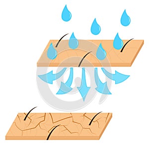 Skin hydration and dry skin sectional view.