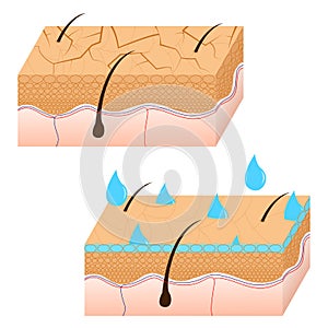 Skin hydration and dry skin sectional view.