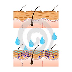 Skin hydration sectional view.