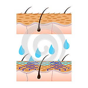 Skin hydration sectional view.