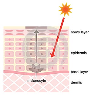 Skin mechanism of blotches