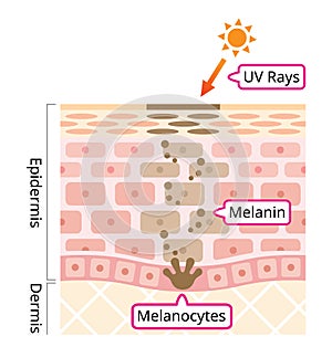 Skin mechanism of melanin and facial dark spots. Infographic human skin layer illustration. Beauty and skin care concept