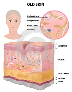 The skin of an old woman, wrinkles, detailed illustration, medicine, vector