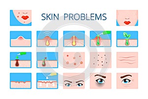 Skin problem. hygiene infographic damaged skin dark circles face infection ages wrinkles clogged pores zits vector