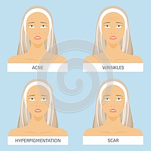 Skin problems: acne, wrinkles, hyperpigmentation, scars. Face of woman