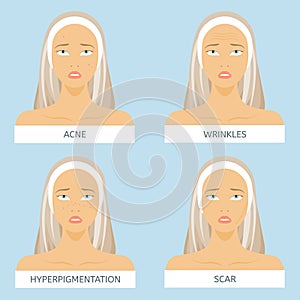 Skin problems: acne, wrinkles, hyperpigmentation, scars. Face of woman photo