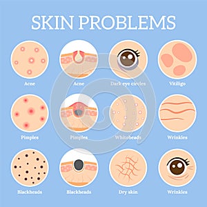 Skin problems. Ages wrinkles problem, face skin infection treatment and dark circles under eyes vector icons set photo