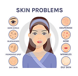 Skin problems close-up. Beautiful Brunette Woman and facial Diseases: Acne, Blackheads,Dry,Oily,Wrinkles,Dark circles,Couperose, photo