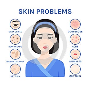 Skin problems. Isolated Asian Woman and Care, Treatment. Korean Girl has Acne, Black Dots, Wrinkles, Dark Circles, Dry and Oily