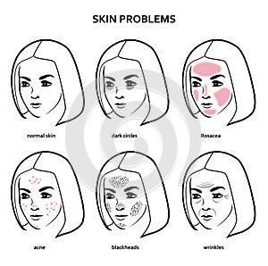 Skin problems of modern woman