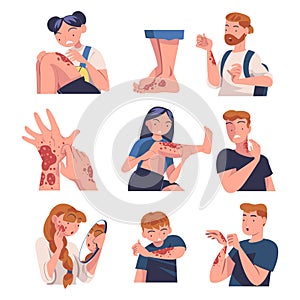 Skin Problems with People Character Suffering Scratching Itching Skin Vector Set
