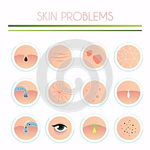 Skin problems solution, home remedies. Skincare and dermatology