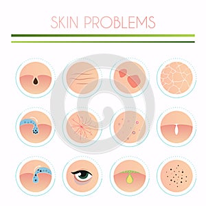 Skin problems solution, home remedies. Skincare and dermatology photo