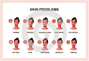 Skin problems vector concept. Skin health and care