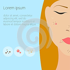 Skin problems Vector illustration