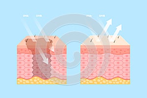 Skin protection from ultraviolet rays effect set