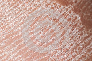 Skin with sebaceous secretions on the human heel close-up, macro