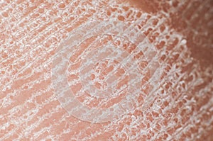 Skin with sebaceous secretions on the human heel close-up, macro photo