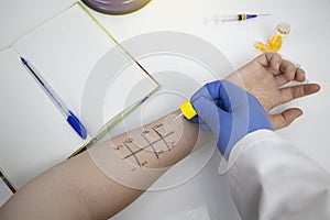An allergist doctor in the laboratory conducts a prik allergy test. Skin test for household, food, epidermal allergic reactions photo