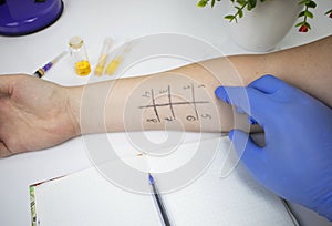 An allergist doctor in the laboratory conducts a prik allergy test. Skin test for household, food, epidermal allergic reactions photo