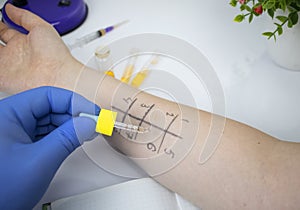 An allergist doctor in the laboratory conducts a prik allergy test. Skin test for household, food, epidermal allergic reactions photo