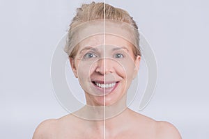 Before and after skin treatment