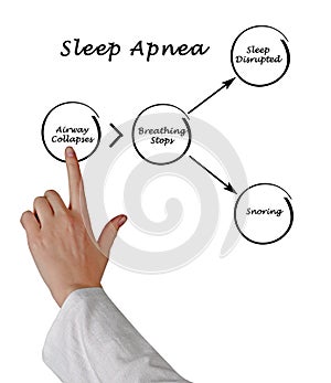 Sleep Apnea