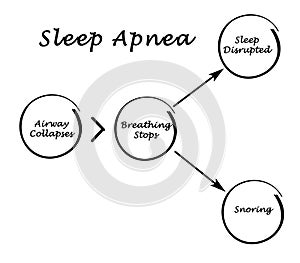 Sleep Apnea