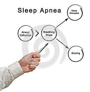 Sleep Apnea chain