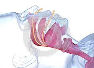 Sleep apnea syndrome. Labeled nasal tongue blocked airway, 3D animation