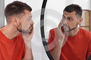 Sleep deprived man looking at himself in mirror indoors