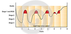 Sleep graph photo