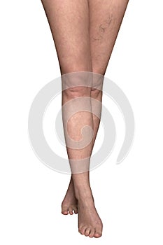 Slender female legs with protruding veins. photo