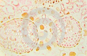 Slice fern leaf under a microscope, (Fern Leaf Sec.),