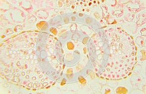 Slice fern leaf under a microscope, (Fern Leaf Sec.), photo